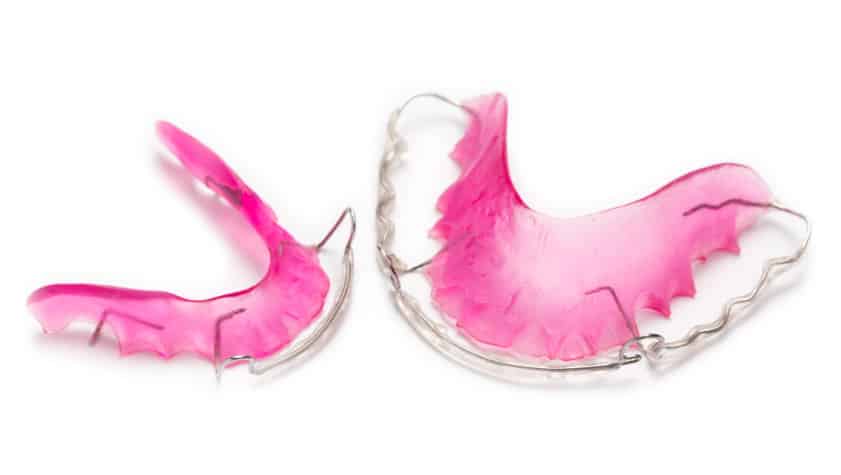 Hawley Retainer from Dr. Dallam