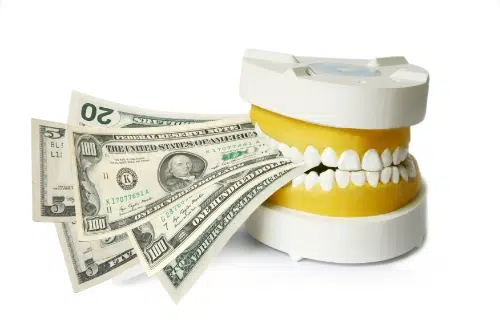 Cost of gold braces