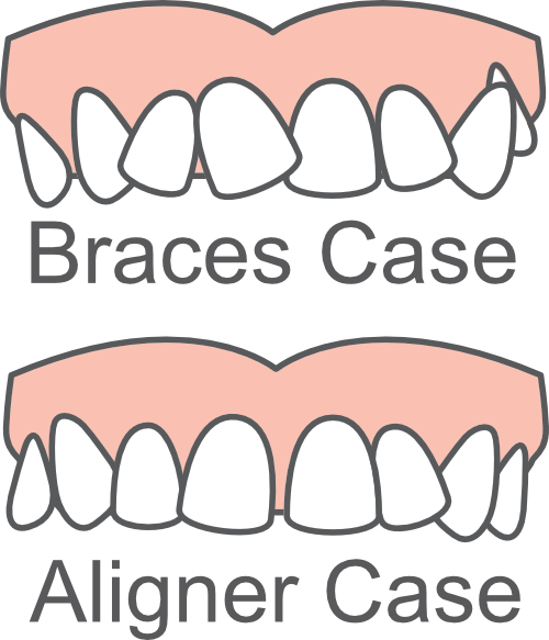 Examples of orthodontic case types