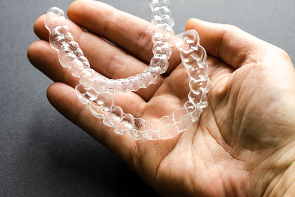 Retainers are important for pos orthodontic care